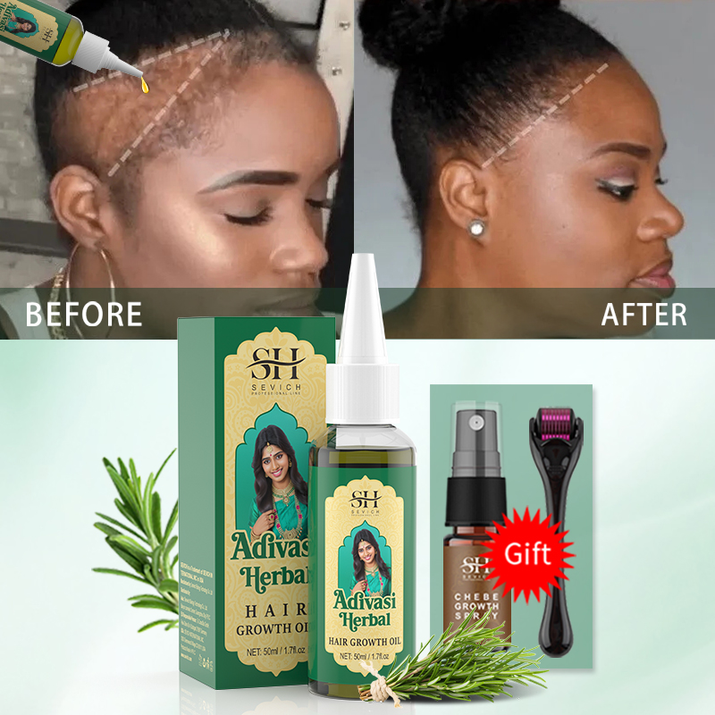 Ayurvedic Hair Growth Oil Indi - đánh giá và giá Ayurvedic & Herbal Wellness Kits