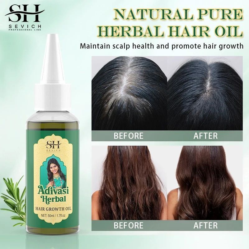 Ayurvedic Hair Growth Oil Indi - đánh giá và giá Ayurvedic & Herbal Wellness Kits